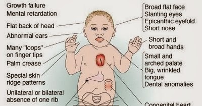 problems that mentally retarded adults face problems that mentally retarded adults face
